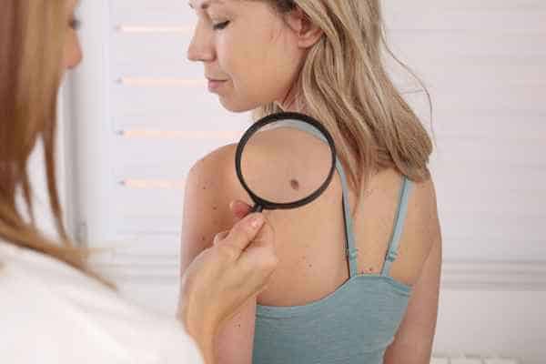 What Are Traditional Skin Lesion Removal Methods Greater Manchester?
