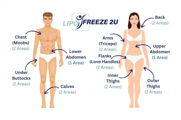 Areas you can have fat freezing treatment Greater Manchester