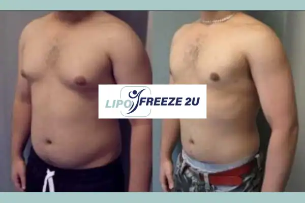 How Long Does It Take to See Results Greater Manchester?