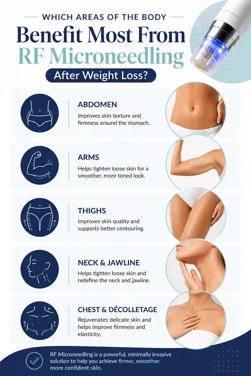 Which Areas of the Body Benefit Most From RF Microneedling After Weight Loss Greater Manchester